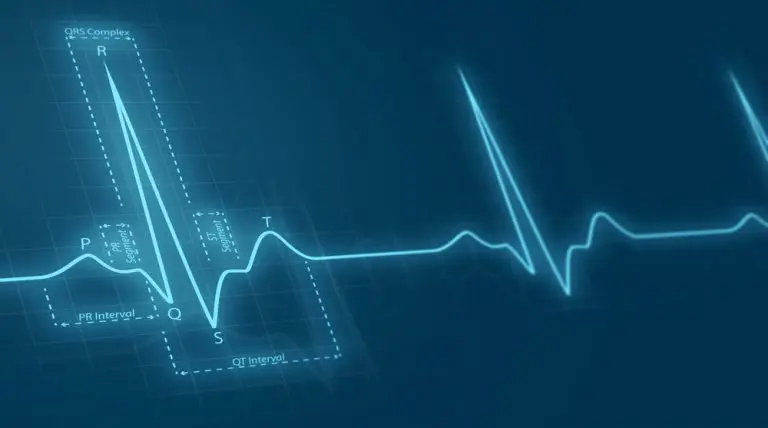 Illustration of an electrocardiogram (ECG) showing a heartbeat graph with labeled sections: P wave, QRS complex, and T wave. The chart is overlaid on a grid background and shows intervals between heartbeats, highlighting the electrical activity in the heart—crucial for those considering Key Man Insurance if you have health problems.